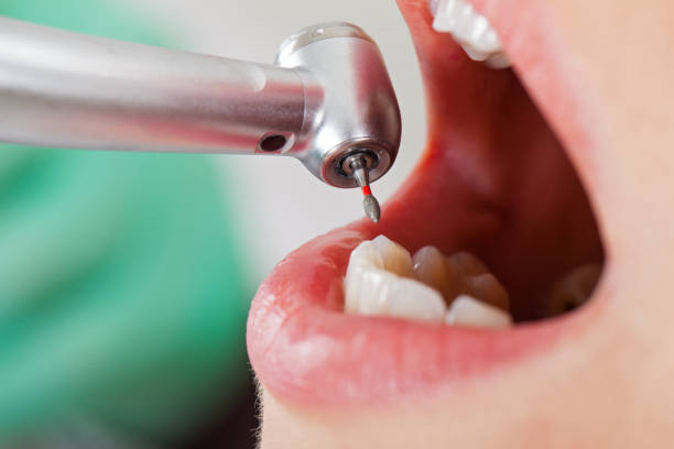 Best Emergency Denture Repair in Berea, OH